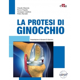 La protesi di ginocchio