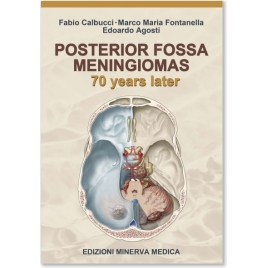 Posterior fossa meningiomas...