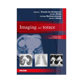 Imaging del torace