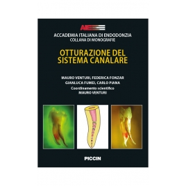 Otturazione del sistema...